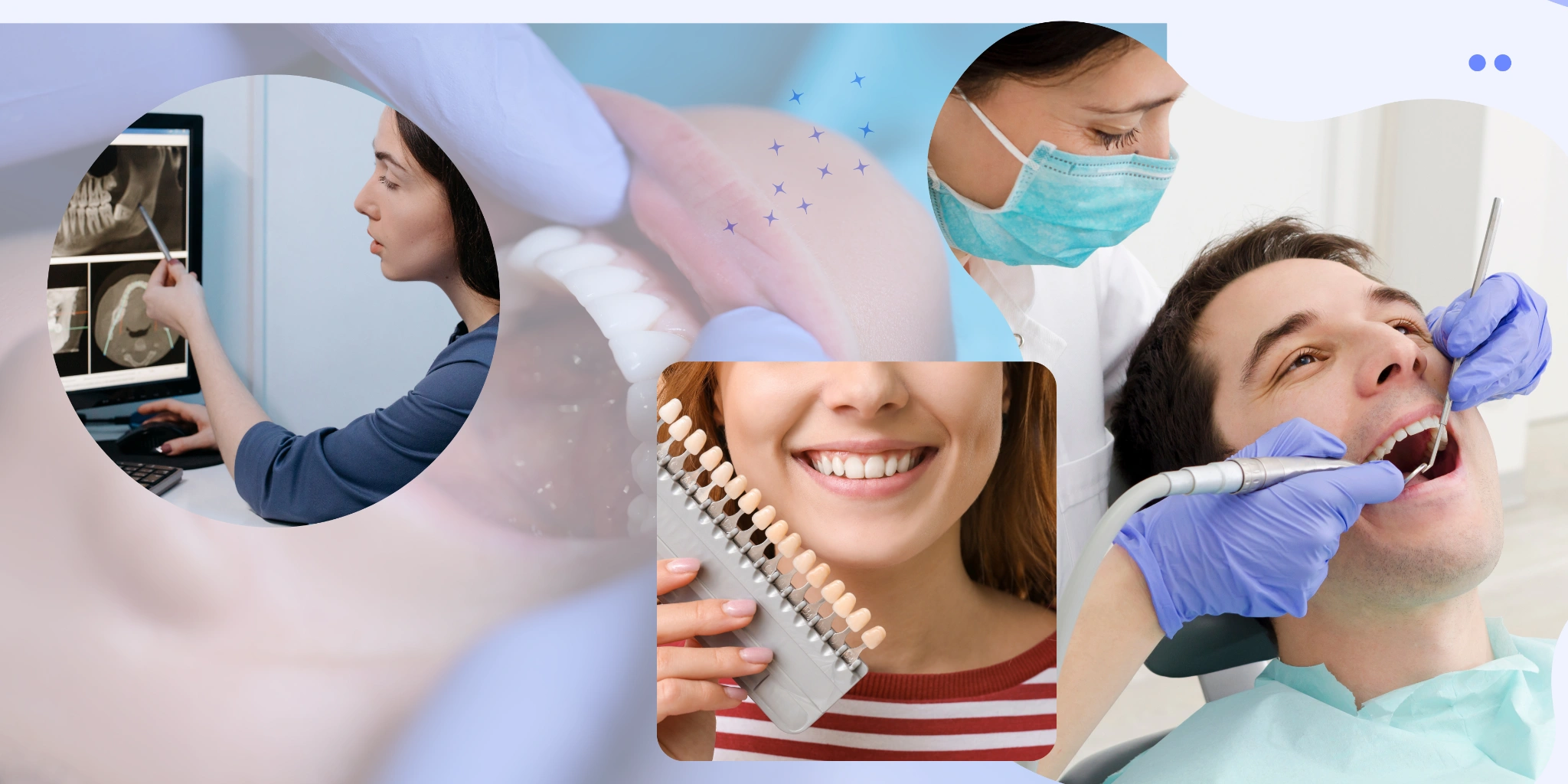 Veneers Explained: Types, Costs, and What to Expect