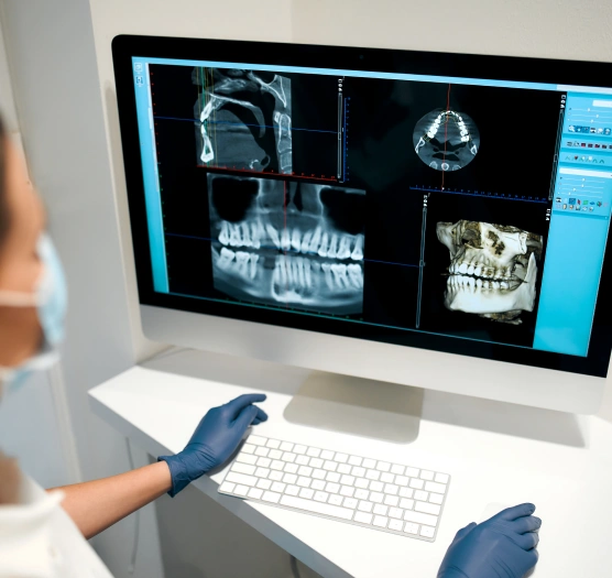 AI diagnostic technology at Ro Dental Group in Calgary, Alberta displaying detailed 3D dental X-ray images to support accurate diagnosis and treatment planning.
